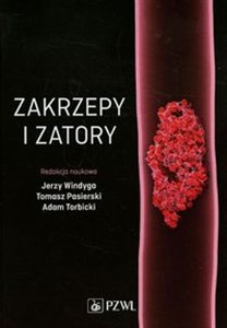 Zakrzepy i zatory online polish bookstore