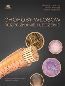 Choroby włosów. Rozpoznanie i leczenie  