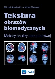 Tekstura obrazów biomedycznych Metody analizy komputerowej  