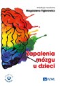 Zapalenia mózgu u dzieci  - Magdalena Figlerowicz bookstore